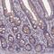 5',3'-Nucleotidase, Mitochondrial antibody, PA5-60504, Invitrogen Antibodies, Immunohistochemistry frozen image 