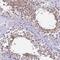 Defensin Beta 107B antibody, NBP2-59793, Novus Biologicals, Immunohistochemistry paraffin image 