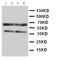 C-C Motif Chemokine Receptor 5 (Gene/Pseudogene) antibody, LS-C343858, Lifespan Biosciences, Western Blot image 
