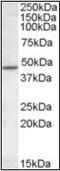 Cholinergic Receptor Nicotinic Beta 2 Subunit antibody, orb96408, Biorbyt, Western Blot image 