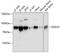 DEAD-Box Helicase 3 Y-Linked antibody, A06062-2, Boster Biological Technology, Western Blot image 