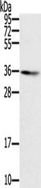 Sorting Nexin 11 antibody, TA350439, Origene, Western Blot image 