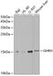 Growth Hormone Releasing Hormone antibody, A01699, Boster Biological Technology, Western Blot image 