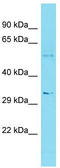 Major Facilitator Superfamily Domain Containing 2B antibody, TA334891, Origene, Western Blot image 