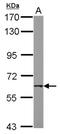 Acetylcholine receptor subunit beta antibody, NBP2-19540, Novus Biologicals, Western Blot image 