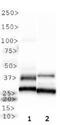 Melatonin Receptor 1B antibody, NLS932, Novus Biologicals, Western Blot image 
