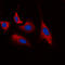 Cyclin Dependent Kinase 5 antibody, GTX32375, GeneTex, Immunocytochemistry image 