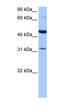 Putative protein TPRXL antibody, orb325680, Biorbyt, Western Blot image 