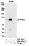 VPS18 Core Subunit Of CORVET And HOPS Complexes antibody, A305-543A, Bethyl Labs, Immunoprecipitation image 