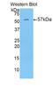 N-Acetyl-Alpha-Glucosaminidase antibody, LS-C302511, Lifespan Biosciences, Western Blot image 