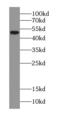 Choline kinase alpha antibody, FNab01666, FineTest, Western Blot image 