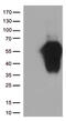 Hepatitis A Virus Cellular Receptor 2 antibody, CF812500, Origene, Western Blot image 