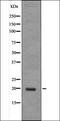 Jun dimerization protein 2 antibody, orb335944, Biorbyt, Western Blot image 