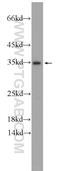 Probable gluconokinase antibody, 24831-1-AP, Proteintech Group, Western Blot image 
