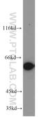 CAP-50 antibody, 10479-2-AP, Proteintech Group, Western Blot image 