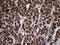 Translocase Of Inner Mitochondrial Membrane 8A antibody, M07659, Boster Biological Technology, Immunohistochemistry paraffin image 