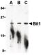 Peptidyl-tRNA hydrolase 2, mitochondrial antibody, PA5-20167, Invitrogen Antibodies, Western Blot image 