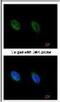 ATR Serine/Threonine Kinase antibody, NB100-308, Novus Biologicals, Immunofluorescence image 