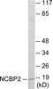 Nuclear Cap Binding Protein Subunit 2 antibody, EKC1739, Boster Biological Technology, Western Blot image 