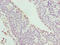 Cytochrome B-245 Chaperone 1 antibody, LS-C397264, Lifespan Biosciences, Immunohistochemistry paraffin image 