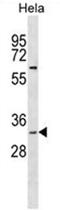 3'(2'), 5'-Bisphosphate Nucleotidase 1 antibody, AP50387PU-N, Origene, Western Blot image 