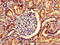 Small Nuclear Ribonucleoprotein D1 Polypeptide antibody, CSB-PA022332LA01HU, Cusabio, Immunohistochemistry paraffin image 