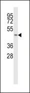 Solute Carrier Family 38 Member 5 antibody, LS-C161234, Lifespan Biosciences, Western Blot image 