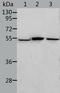 Aldehyde Dehydrogenase 3 Family Member B1 antibody, TA323582, Origene, Western Blot image 