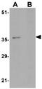 PAXIP1 Associated Glutamate Rich Protein 1 antibody, GTX85239, GeneTex, Western Blot image 