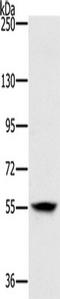 Loxl antibody, TA351361, Origene, Western Blot image 