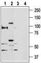Transient Receptor Potential Cation Channel Subfamily V Member 5 antibody, TA328743, Origene, Western Blot image 