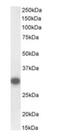 SCP1 antibody, orb377876, Biorbyt, Western Blot image 