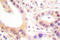 ETS Proto-Oncogene 1, Transcription Factor antibody, AP06524PU-N, Origene, Immunohistochemistry paraffin image 