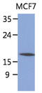 Signal Sequence Receptor Subunit 4 antibody, MBS200275, MyBioSource, Western Blot image 