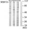 Mitogen-Activated Protein Kinase Kinase Kinase 13 antibody, PA5-49765, Invitrogen Antibodies, Western Blot image 
