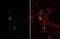 BAF Chromatin Remodeling Complex Subunit BCL11B antibody, GTX134767, GeneTex, Immunofluorescence image 