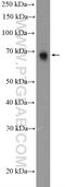 Lysine-specific demethylase 4D antibody, 22591-1-AP, Proteintech Group, Western Blot image 