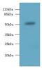 Solute Carrier Family 38 Member 2 antibody, LS-C378748, Lifespan Biosciences, Western Blot image 