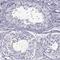 Speedy/RINGO Cell Cycle Regulator Family Member E1 antibody, PA5-62470, Invitrogen Antibodies, Immunohistochemistry paraffin image 