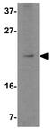Serine/Threonine Kinase 39 antibody, GTX31785, GeneTex, Western Blot image 