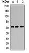 Solute carrier family 22 member 4 antibody, MBS8231396, MyBioSource, Western Blot image 