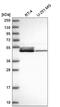 DnaJ Heat Shock Protein Family (Hsp40) Member A4 antibody, NBP2-58975, Novus Biologicals, Western Blot image 