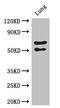 EGF-containing fibulin-like extracellular matrix protein 2 antibody, CSB-PA007451LA01HU, Cusabio, Western Blot image 