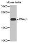 Dynein light chain 1, axonemal antibody, A12371-2, Boster Biological Technology, Western Blot image 