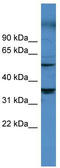 Cytochrome P450 Family 11 Subfamily B Member 1 antibody, TA342858, Origene, Western Blot image 