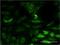 5',3'-Nucleotidase, Mitochondrial antibody, H00056953-M02, Novus Biologicals, Immunofluorescence image 