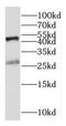 Inducible T Cell Costimulator antibody, FNab04110, FineTest, Western Blot image 