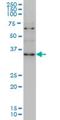 Zic Family Member 4 antibody, H00084107-M09, Novus Biologicals, Western Blot image 