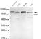 Ubiquitin Like With PHD And Ring Finger Domains 1 antibody, TA347069, Origene, Western Blot image 