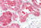 Succinate dehydrogenase [ubiquinone] cytochrome b small subunit, mitochondrial antibody, MBS248258, MyBioSource, Immunohistochemistry frozen image 